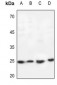 Anti-Cardiotrophin-1 Antibody