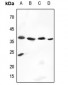 Anti-Cathepsin V Antibody