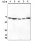 Anti-Cytochrome P450 27A1 Antibody