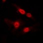 Anti-DGK alpha Antibody