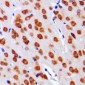 Anti-DGK alpha Antibody