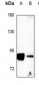 Anti-DGK alpha Antibody