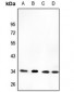 Anti-CYB5R3 Antibody