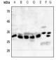 Anti-NQO1 Antibody