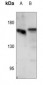 Anti-EGFR (pS1071) Antibody