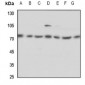 Anti-ELF4 Antibody