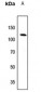 Anti-EPB41L2 Antibody