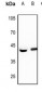 Anti-FEN1 Antibody