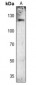 Anti-FGFR1 (pY654) Antibody