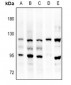 Anti-FGFR3 Antibody