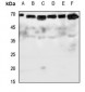 Anti-Glypican 5 Antibody