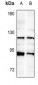 Anti-FGFR2 Antibody