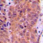 Anti-FOXO1 (pS319) Antibody