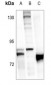 Anti-FOXO1 (pS319) Antibody