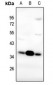 Anti-FR alpha Antibody