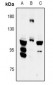 Anti-FYB Antibody