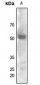 Anti-FYN (pY530) Antibody
