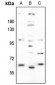 Anti-GABRA4 Antibody