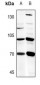 Anti-B4GALNT1 Antibody