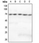 Anti-GRK5 Antibody