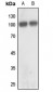 Anti-GLUR2 Antibody