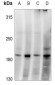 Anti-GRLF1 (pY1087) Antibody