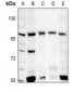 Anti-mGLUR6 Antibody
