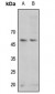 Anti-GSK3 alpha (pS21) Antibody