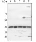 Anti-GTF2E2 Antibody