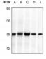 Anti-GYS1 Antibody