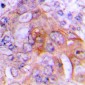 Anti-HADH2 Antibody