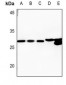 Anti-HADH2 Antibody