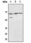 Anti-Histone Deacetylase 1 (pS421) Antibody