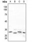 Anti-Neuregulin SMDF Antibody