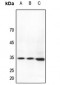 Anti-HOXB4 Antibody