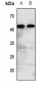 Anti-Histamine H2 Receptor Antibody