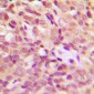 Anti-HSP27 (pS15) Antibody