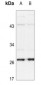 Anti-HSP27 (pS15) Antibody