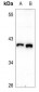 Anti-HSP40 Antibody