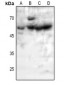 Anti-5-HT2B Antibody