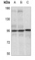 Anti-IGF1 Receptor (pY1165/Y1166) Antibody