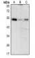 Anti-CD122 Antibody