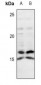 Anti-IL-4 Antibody