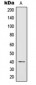 Anti-IL-12B Antibody