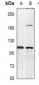 Anti-Insulin Receptor Antibody