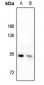 Anti-IRAK1 (pT209) Antibody