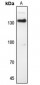 Anti-CD51 Antibody