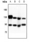 Anti-CD51 HC Antibody