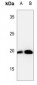 Anti-Cofilin (pS3) Antibody