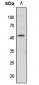 Anti-c-Jun (pT91) Antibody